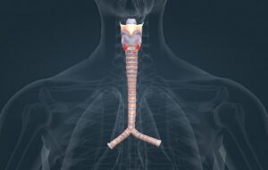 Colocação de Órtese Traqueal