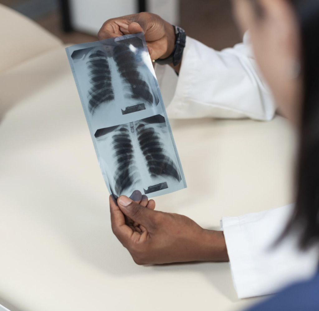 Pneumotórax espontâneo em jovens: causas e prevenção