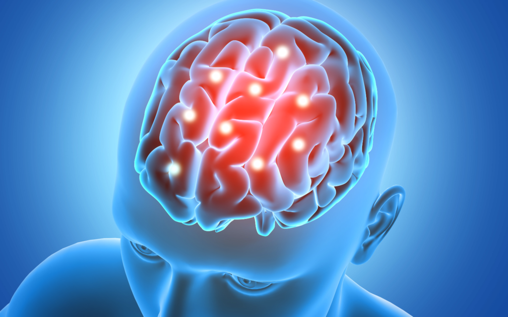 Cirurgia reduz sintomas da doença de Parkinson