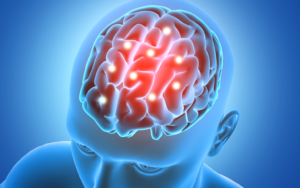 Cirurgia reduz sintomas da doenca de Parkinson