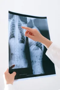 Pneumologista o medico responsavel pelo tratamento de doencas pulmonares