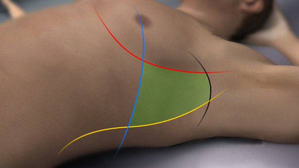 dreno toracico20211208