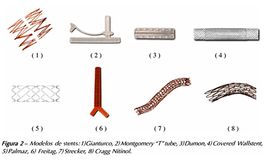 colocacao ortese traqueal1
