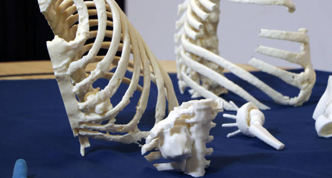 tumores de parede toracica20211210