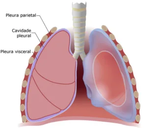 pleurodese