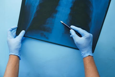 doencas toracicas e sinais de alerta20250915