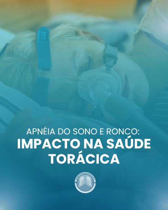 Apneia do sono e ronco: impacto na saúde torácica