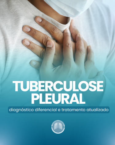 Tuberculose pleural: diagnóstico diferencial e tratamento atualizado